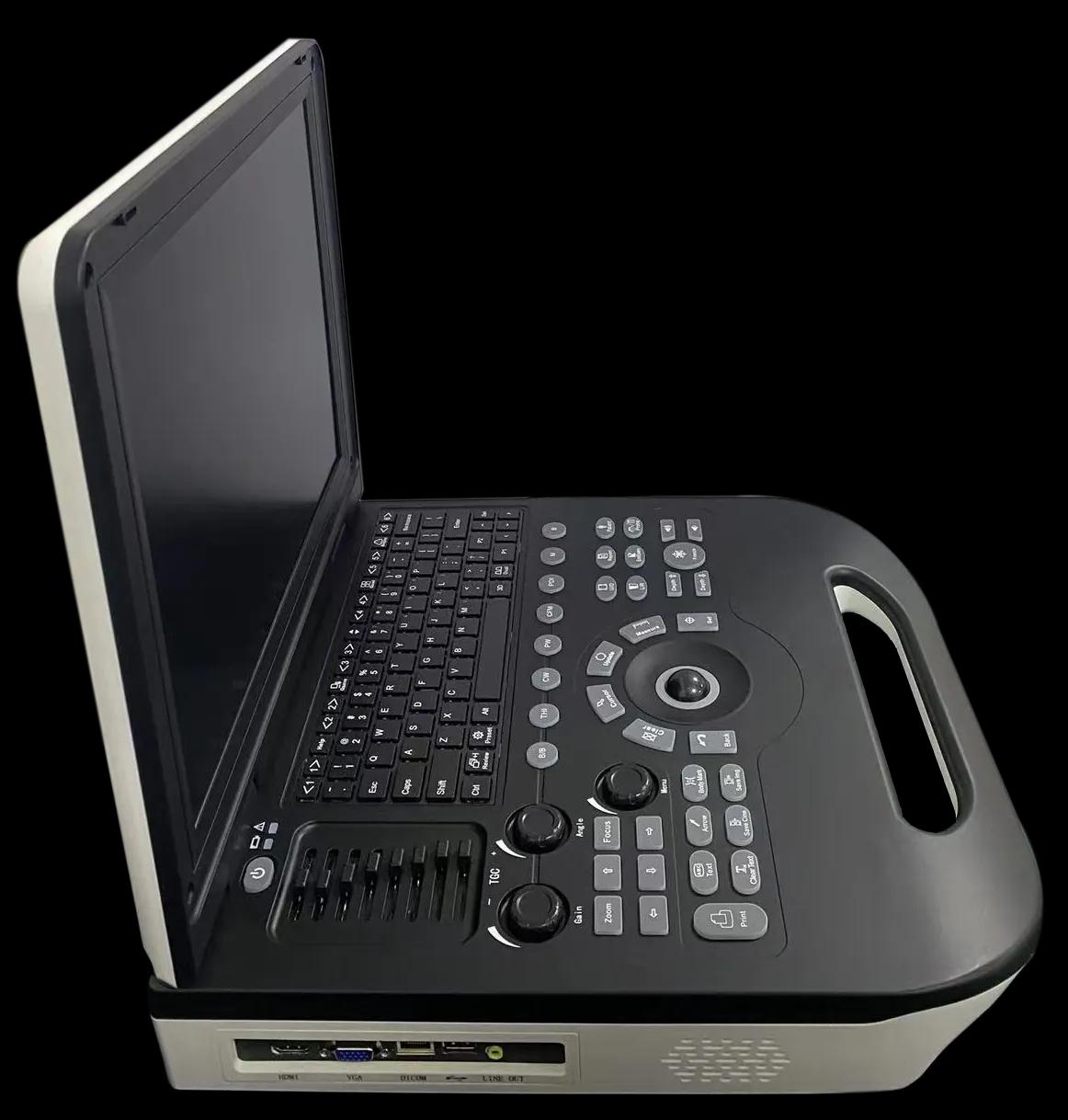 Échographe Médical Portable Doppler Algerie Couleur Chiangfeng E30 échographe portable médical en Algérie