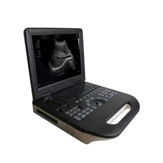 echographe portable doppler couleur chiangfeng e30 algerie - miniature 7